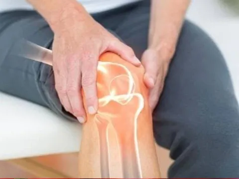 3 loại nước quen mặt nhưng âm thầm “rút sạch” canxi trong xương: Uống nhiều chỉ khiến xương giòn, dễ gãy