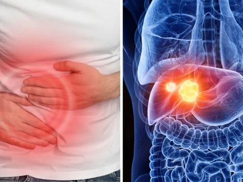 “2 đau 1 vàng” dấu hiệu cảnh báo ung thư gan đang âm thầm phát triển: Chủ quan tính mạng tính từng ngày