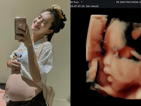 Diễn viên Quỳnh Lương kiệt sức ở tháng thứ 8 thai kỳ lần 2: Đau đớn toàn thân, khó khăn di chuyển