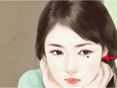 3 nốt ruồi phá tài: Trẻ thì lận đận công danh, già thì hao tài nghèo khổ