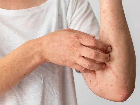 4 dấu hiệu cảnh báo K sớm: Có 1 cũng nên đi khám sớm