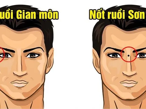 4 nốt ruồi phá hủy Phúc Lộc: Ai có tuổi trẻ gian nan, cuối đời túng thiếu cô độc