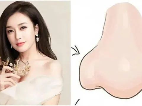 90% người giàu có sở hữu tướng mũi này: Không chỉ đẹp mà còn vượng