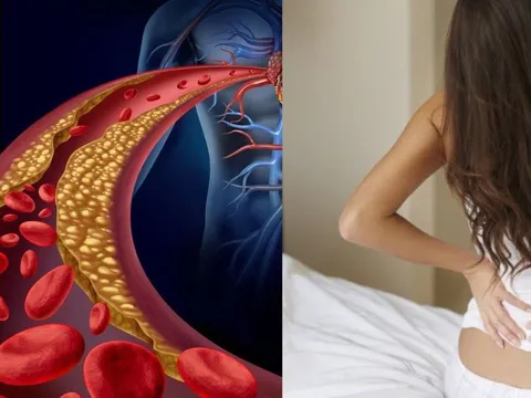 Người gầy vẫn bị mỡ máu cao vì những lý do này