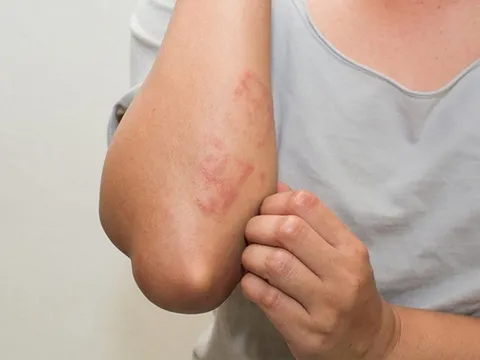 4 dấu hiệu cảnh báo thận của bạn đang kêu cứu: Có 1 cũng nên đi khám sớm