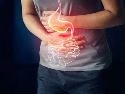 Ung thư dạ dày gia tăng nhanh chóng: 4 thói quen hàng ngày là "thủ phạm giấu mặt"