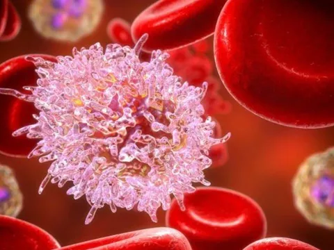Tin vui Đột phá khoa học: Vắc xin mRNA chống mọi loại Ung Thư sắp ra đời?