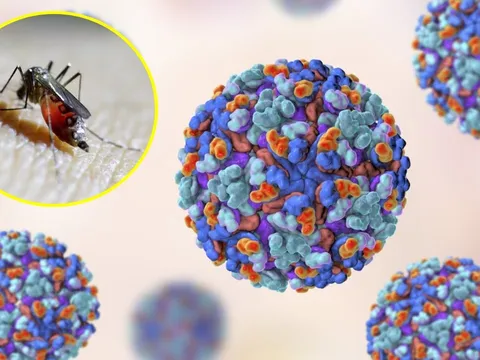 WHO cảnh báo nguy cơ bùng phát dịch do một loại virus, 5,6 tỷ người đứng trước mối nguy hiểm nhiễm bệnh