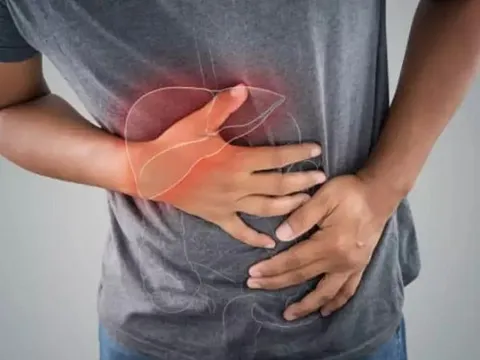 4 dấu hiệu cảnh báo bệnh gan sớm: Có 1/4 cũng nên đi kiểm tra sức khỏe sớm