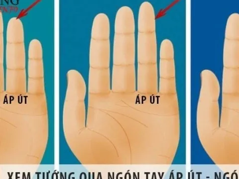 Ngón áp út có 1 trong 5 dấu hiệu này, ai cũng mang mệnh giàu sang phú quý, tiền bạc rủng rỉnh
