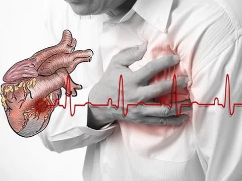 Ông Hoàng Nam Tiến đột ngột qua đời: Cảnh báo biến cố tim đe doạ cả người khoẻ mạnh