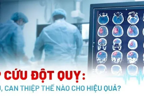 Cách sơ cứu đột quỵ tại nhà đúng cách nhất