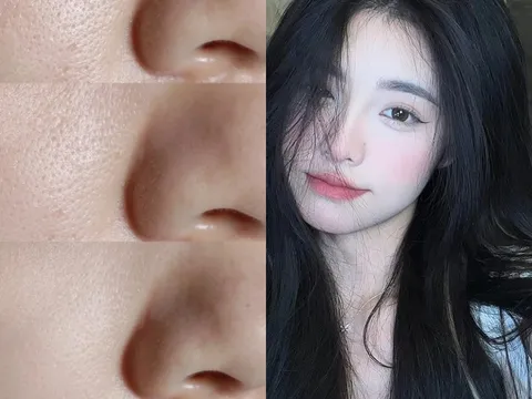 Qua 30 tuổi, nhớ áp dụng 7 cách này để da căng mướt, thu nhỏ lỗ chân lông