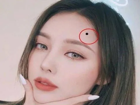 Nốt ruồi phát tài nằm ở đâu? Thầy tướng số tiết lộ: Ai sở hữu, tiền vào như nước, giàu sang khó tránh