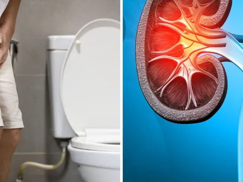 3 dấu hiệu vào ban đêm cảnh báo bệnh thận: Bỏ lỡ hối hận cả đời