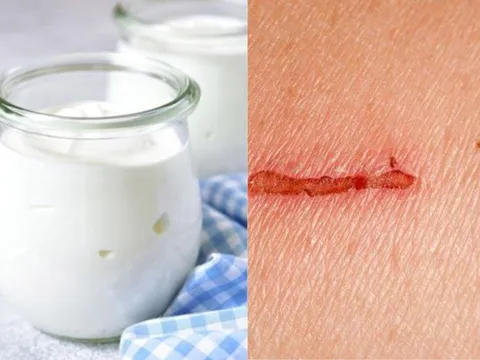 Nghiên cứu mới: Làm Gel trị thương từ sữa chua