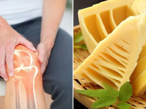 Vì sao người bị nhức xương khớp không nên ăn măng?