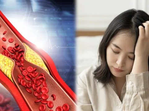 4 việc giúp làm sạch mạch máu, ngăn ngừa lão hóa