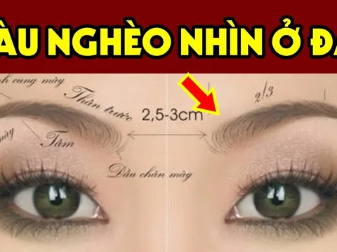 Người có điểm này trên mặt: Cực kỳ may mắn, Trúng Số Giàu To, đó là gì?