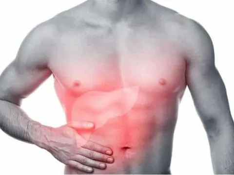 4 dấu hiệu cảnh báo gan của bạn đang kêu cứu ở giai đoạn nặng: Có 1 cũng nên đi khám sớm