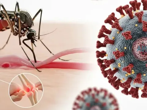 Bệnh Chikungunya đang có xu hướng bùng phát: Cảnh báo 2 nhóm người có nguy cơ mắc bệnh nặng hơn