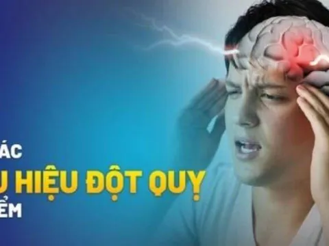 7 dấu hiệu cảnh báo đột quỵ trước 1 tuần: Nhận biết sớm để cứu mạng