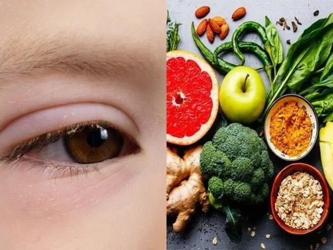 Mắt xuất hiện 3 dấu hiệu bất thường, coi chừng cholesterol trong máu quá cao: Khi rửa mặt nhất định phải chú ý