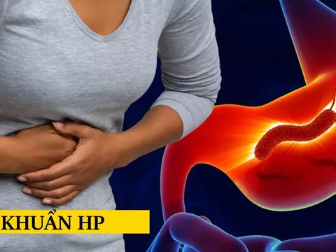 Vi khuẩn HP sợ 5 loại thực phẩm này nhất, nên ăn để bảo vệ dạ dày