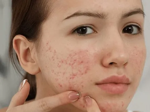 5 tác hại khi không rửa mặt sau khi đắp mặt nạ mà nhiều người không ngờ tới