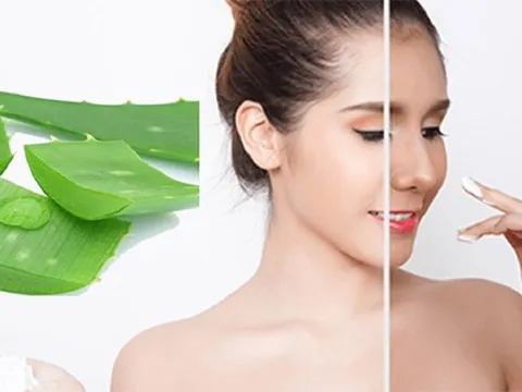 4 mặt nạ từ nha đam “giải khát ”tức thì cho làn da, giúp da sáng khỏe hơn