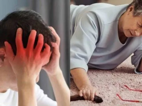 Đột quỵ ngày càng trẻ hóa: Cách phát hiện nhanh trong 30 giây có thể cứu sống người bệnh