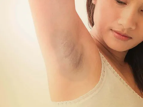 7 mẹo là “cứu tinh” giúp bạn vừa trị thâm, vừa khử mùi hiệu quả