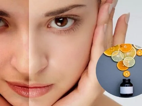 Vitamin C và những sai lầm thường gặp khi chăm sóc da