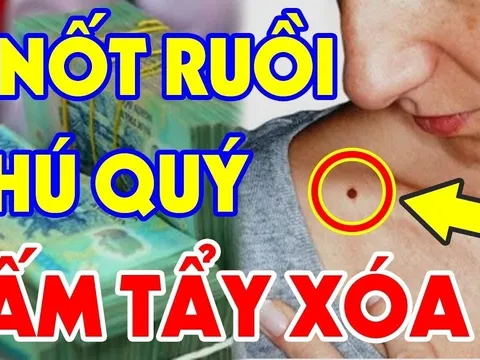 4 nốt ruồi Quý Hơn Vàng Mười, trời định có số giàu