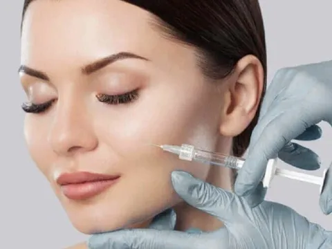 Những điều bạn nhất định phải biết trước và sau khi làm đẹp bằng phương pháp tiêm filler