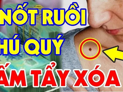 5 nốt ruồi tựa hố chôn tiền: Ai có được thật đáng chúc mừng
