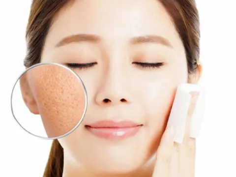 6 mẹo thu  lỗ chân lông như được “thu nhỏ”, giúp da trông mịn màng hơn