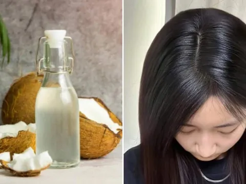 Cách sử dụng dầu dừa giảm rụng tóc, giúp tóc mọc nhanh, không gây bết dính