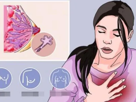 4 loại ung thư có tỷ lệ sống sót gần 100%, trong đó có ung thư vú – Đừng vội từ bỏ điều trị