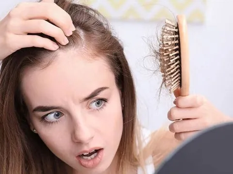 7 loại thực phẩm càng ăn nhiều càng giúp tóc chắc khỏe, giảm gãy rụng rõ rệt