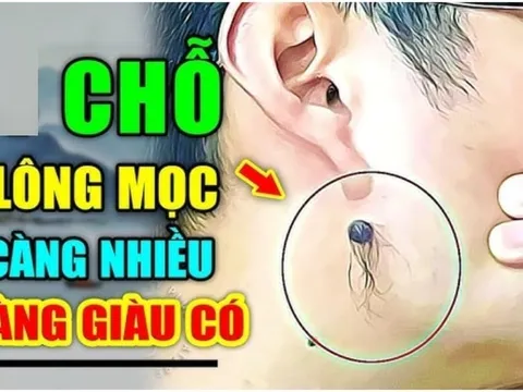 3 chỗ mọc lông Ngồi Không cũng có Tiền, số 1 nhiều người không biết lại nhổ đi