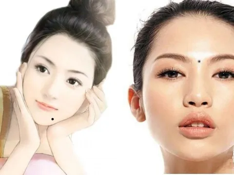 3 vị trí mọc nốt ruồi này báo hiệu số phú quý, cả đời phúc lộc dồi dào, tiền tài không bao giờ thiếu