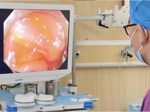 22 tuổi mắc ung thư kết tràng: Thói quen xấu đang âm thầm ‘bào mòn’ ruột non giới trẻ