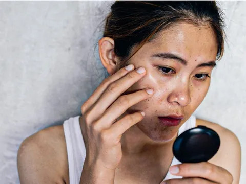 2 lưu ý cơ bản giúp cải thiện tình trạng da xỉn màu, sạm đen