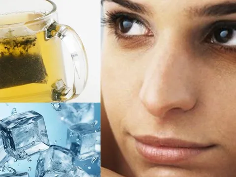Cách giảm thâm quầng mắt chỉ cần trà và đá lạnh