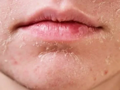 4 dấu hiệu thay đổi trên khuôn mặt cảnh báo ung thư cổ tử cung, phụ nữ cần lưu ý ngay