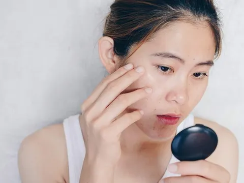 5 hoạt chất chống lão hóa cần thiết cho làn da sau tuổi 30