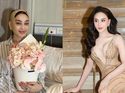 Lâm Khánh Chi gây chú ý với diện mạo sau phẫu thuật thẩm mỹ