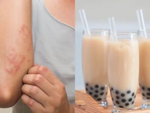 3 món ngọt âm thầm phá hủy lá gan, nhiều người Việt vẫn vô tư ăn hằng ngày