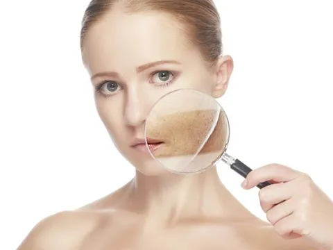 4 lỗi thường gặp khị trị nám khiến da ngày càng xuống cấp